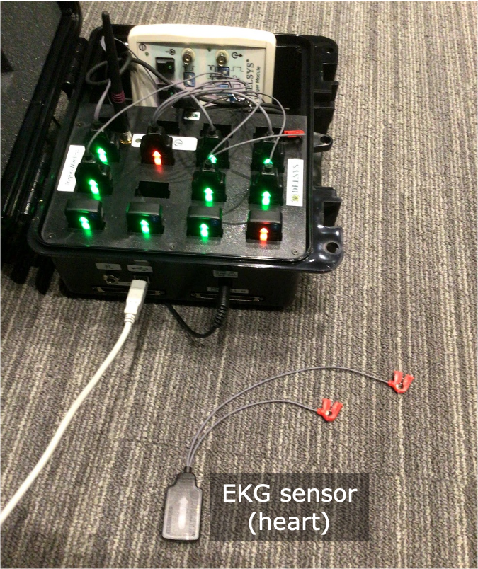EKG sensor